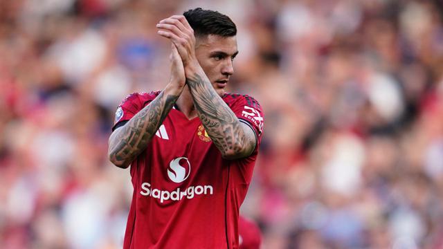 069217300_1755490450-sesko